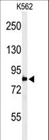 PLA2G4B Antibody - Western blot of PLA2G4B Antibody in K562 cell line lysates (35 ug/lane). PLA2G4B (arrow) was detected using the purified antibody.