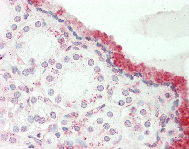 PLA2G4B Antibody - Human Thyroid: Formalin-Fixed, Paraffin-Embedded (FFPE).  This image was taken for the unconjugated form of this product. Other forms have not been tested.