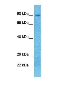 PLA2G4B Antibody - Western blot of Human MCF7. PLA2G4B antibody dilution 1.0 ug/ml.  This image was taken for the unconjugated form of this product. Other forms have not been tested.