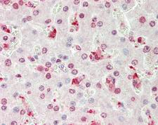 PLA2G4B Antibody - Human Liver: Formalin-Fixed, Paraffin-Embedded (FFPE).  This image was taken for the unconjugated form of this product. Other forms have not been tested.