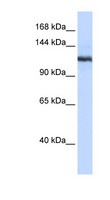 PLA2G4B Antibody - PLA2G4B / CPLA2-Beta antibody Western blot of 293T cell lysate. This image was taken for the unconjugated form of this product. Other forms have not been tested.
