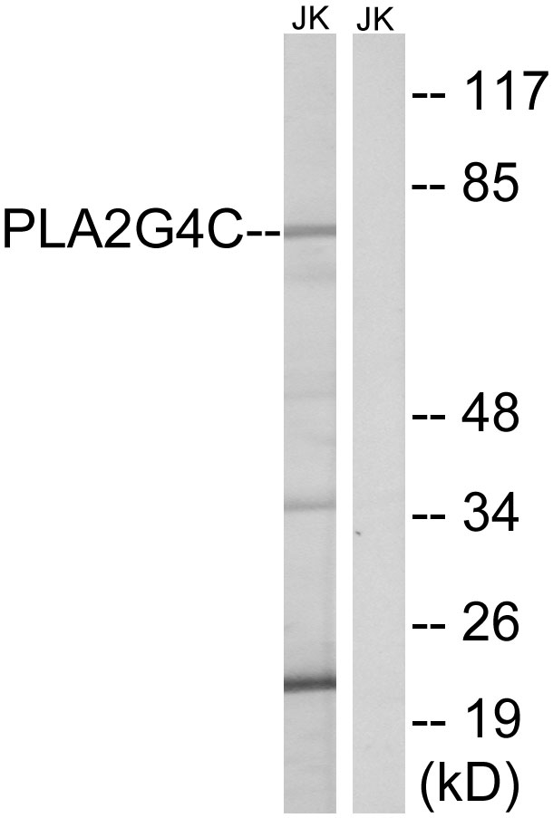 PLA2G4C Antibody - Western blot analysis of lysates from Jurkat cells, using PLA2G4C Antibody. The lane on the right is blocked with the synthesized peptide.
