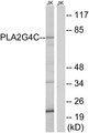 PLA2G4C Antibody - Western blot analysis of lysates from Jurkat cells, using PLA2G4C Antibody. The lane on the right is blocked with the synthesized peptide.