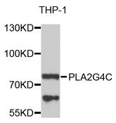 PLA2G4C Antibody - Western blot analysis of extracts of THP-1 cells.