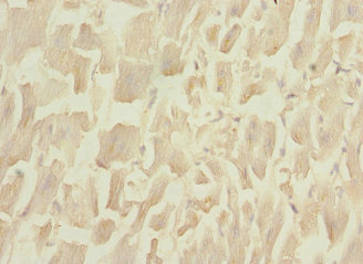 PLA2G4C Antibody - Immunohistochemistry of paraffin-embedded human heart tissue at dilution 1:100