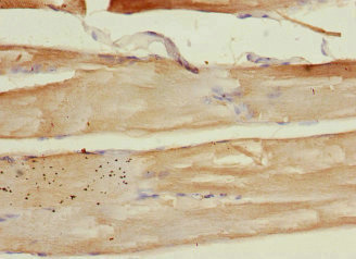 PLA2G4C Antibody - Immunohistochemistry of paraffin-embedded human skeletal muscle tissue at dilution 1:100