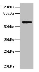 PLA2G4C Antibody - Western blot All Lanes: COX10 antibody at 5.84ug/ml+ Mouse heart tissue Goat polyclonal to rabbit at 1/10000 dilution Predicted band size: 61,60,63 kDa Observed band size: 61 kDa