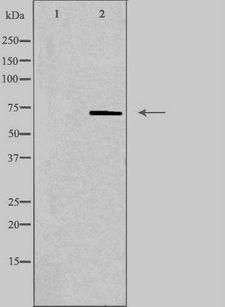 PLA2G4C Antibody - Western blot analysis of extracts of Jurkat cells using PLA2G4C antibody. The lane on the left is treated with the antigen-specific peptide.