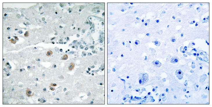 PLA2G4D Antibody - Immunohistochemistry analysis of paraffin-embedded human brain, using PLA2G4D Antibody. The picture on the right is blocked with the synthesized peptide.