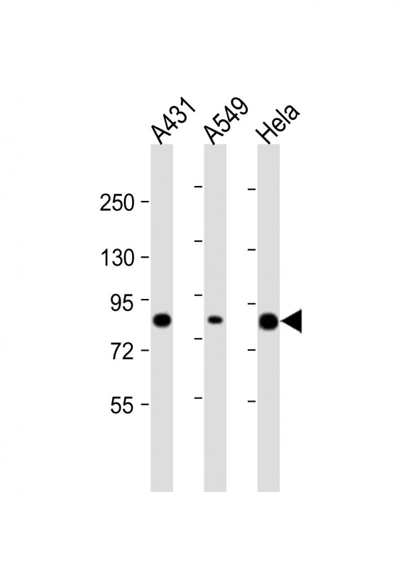 PLA2G4D Antibody - All lanes: Anti-PLA2G4D Antibody (C-Term) at 1:2000 dilution. Lane 1: A431 whole cell lysate. Lane 2: A549 whole cell lysate. Lane 3: HeLa whole cell lysate Lysates/proteins at 20 ug per lane. Secondary Goat Anti-Rabbit IgG, (H+L), Peroxidase conjugated at 1:10000 dilution. Predicted band size: 92 kDa. Blocking/Dilution buffer: 5% NFDM/TBST.