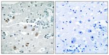 PLA2G4D Antibody - Peptide - + Immunohistochemistry analysis of paraffin-embedded human brain tissue using PLA2G4D antibody.