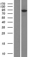 PLA2G4D Protein - Western validation with an anti-DDK antibody * L: Control HEK293 lysate R: Over-expression lysate
