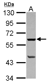 PLA2G4F Antibody - Sample (30 ug of whole cell lysate) A: 293T 10% SDS PAGE PLA2G4F / CPLA2-zeta antibody diluted at 1:1000