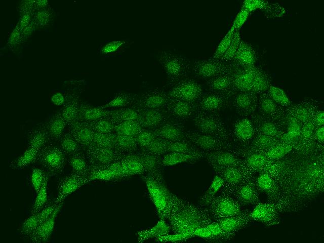 PLA2G4F Antibody - Immunofluorescence staining of PLA2G4F in A431 cells. Cells were fixed with 4% PFA, permeabilzed with 0.1% Triton X-100 in PBS, blocked with 10% serum, and incubated with rabbit anti-Human PLA2G4F polyclonal antibody (dilution ratio 1:200) at 4°C overnight. Then cells were stained with the Alexa Fluor 488-conjugated Goat Anti-rabbit IgG secondary antibody (green). Positive staining was localized to Nucleus and Cytoplasm.