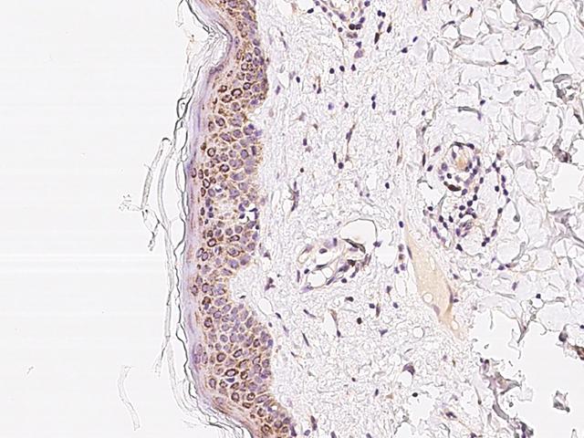 PLA2G4F Antibody - Immunochemical staining of human PLA2G4F in human skin with rabbit polyclonal antibody at 1:100 dilution, formalin-fixed paraffin embedded sections.