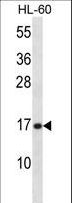 PLA2G5 Antibody - PLA2G5 Antibody western blot of HL-60 cell line lysates (35 ug/lane). The PLA2G5 antibody detected the PLA2G5 protein (arrow).
