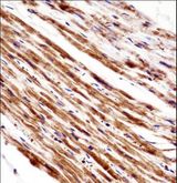 PLA2G5 Antibody - PLA2G5 Antibody immunohistochemistry of formalin-fixed and paraffin-embedded human heart tissue followed by peroxidase-conjugated secondary antibody and DAB staining.