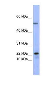 PLA2G5 Antibody - PLA2G5 antibody Western blot of Fetal Thymus lysate. This image was taken for the unconjugated form of this product. Other forms have not been tested.