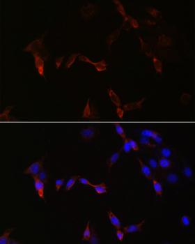 PLA2G5 Antibody - Immunofluorescence analysis of NIH/3T3 cells using PLA2G5 Polyclonal Antibody at dilution of 1:100.Blue: DAPI for nuclear staining.