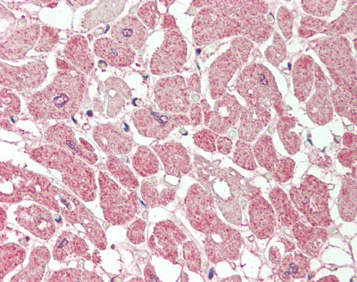 PLA2G5 Antibody - Human Heart: Formalin-Fixed, Paraffin-Embedded (FFPE).  This image was taken for the unconjugated form of this product. Other forms have not been tested.