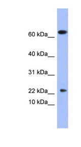 PLA2G5 Antibody - PLA2G5 antibody western blot of Human Fetal Thymus lysate.  This image was taken for the unconjugated form of this product. Other forms have not been tested.