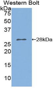 PLA2G6 / IPLA2 Antibody - Western blot of recombinant PLA2G6 / IPLA2.  This image was taken for the unconjugated form of this product. Other forms have not been tested.