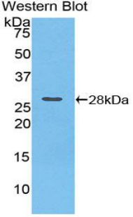PLA2G6 / IPLA2 Antibody - Western blot of recombinant PLA2G6 / IPLA2.  This image was taken for the unconjugated form of this product. Other forms have not been tested.