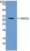 PLA2G6 / IPLA2 Antibody - Western Blot; Sample: Recombinant iPLA2, Human.