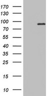 PLA2G6 / IPLA2 Antibody - HEK293T cells were transfected with the pCMV6-ENTRY control (Left lane) or pCMV6-ENTRY PLA2G6 (Right lane) cDNA for 48 hrs and lysed. Equivalent amounts of cell lysates (5 ug per lane) were separated by SDS-PAGE and immunoblotted with anti-PLA2G6.