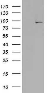PLA2G6 / IPLA2 Antibody - HEK293T cells were transfected with the pCMV6-ENTRY control (Left lane) or pCMV6-ENTRY PLA2G6 (Right lane) cDNA for 48 hrs and lysed. Equivalent amounts of cell lysates (5 ug per lane) were separated by SDS-PAGE and immunoblotted with anti-PLA2G6.