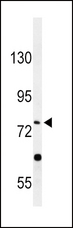 PLA2G6 / IPLA2 Antibody - Western blot of PLA2G6 Antibody in HepG2 cell line lysates (35 ug/lane). PLA2G6 (arrow) was detected using the purified antibody.