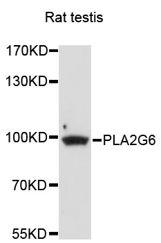 PLA2G6 / IPLA2 Antibody - Western blot analysis of extracts of rat testis cells.