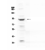 PLA2G6 / IPLA2 Antibody - Western blot - Anti-PLA2G6 antibody