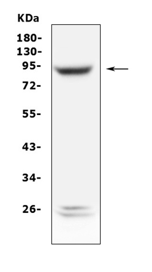 PLA2G6 / IPLA2 Antibody - Western blot analysis of PLA2G6 using anti-PLA2G6 antibody. Electrophoresis was performed on a 5-20% SDS-PAGE gel at 70V (Stacking gel) / 90V (Resolving gel) for 2-3 hours. The sample well of each lane was loaded with 50ug of sample under reducing conditions. Lane 1: human Hela whole cell lysates. After Electrophoresis, proteins were transferred to a Nitrocellulose membrane at 150mA for 50-90 minutes. Blocked the membrane with 5% Non-fat Milk/ TBS for 1.5 hour at RT. The membrane was incubated with rabbit anti-PLA2G6 antigen affinity purified polyclonal antibody at 0.5 µg/mL overnight at 4°C, then washed with TBS-0.1% Tween 3 times with 5 minutes each and probed with a goat anti-rabbit IgG-HRP secondary antibody at a dilution of 1:10000 for 1.5 hour at RT. The signal is developed using an Enhanced Chemiluminescent detection (ECL) kit with Tanon 5200 system. A specific band was detected for PLA2G6 at approximately 90KD. The expected band size for PLA2G6 is at 90KD.