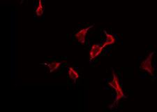 PLA2G6 / IPLA2 Antibody - Staining HeLa cells by IF/ICC. The samples were fixed with PFA and permeabilized in 0.1% Triton X-100, then blocked in 10% serum for 45 min at 25°C. The primary antibody was diluted at 1:200 and incubated with the sample for 1 hour at 37°C. An Alexa Fluor 594 conjugated goat anti-rabbit IgG (H+L) Ab, diluted at 1/600, was used as the secondary antibody.
