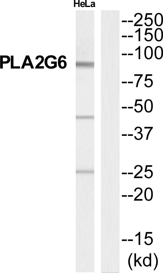 PLA2G6 / IPLA2 Antibody - Western blot analysis of extracts from HeLa cells, using PA2G6 antibody.