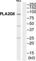 PLA2G6 / IPLA2 Antibody - Western blot analysis of extracts from HeLa cells, using PA2G6 antibody.
