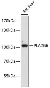 PLA2G6 / IPLA2 Antibody - Western blot analysis of extracts of rat liver using PLA2G6 Polyclonal Antibody at dilution of 1:1000.
