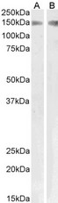 PLA2R / PLA2R1 Antibody - Approx 150kDa band observed in Human Kidney and Pig Lung lysates (calculated MW of 153kDa according to NP_001007268.1). Recommended concentration: 1-3µg/ml.