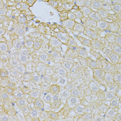 PLA2R / PLA2R1 Antibody - Immunohistochemistry of paraffin-embedded rat liver using PLA2R1 antibodyat dilution of 1:100 (40x lens).