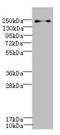 PLA2R / PLA2R1 Antibody - Western blot All Lanes: PLA2R1 antibody IgG at 0.78ug/ml+ Jurkat whole cell lysate Secondary Goat polyclonal to rabbit IgG at 1/10000 dilution Predicted band size: 169,153 kDa Observed band size: 169 kDa