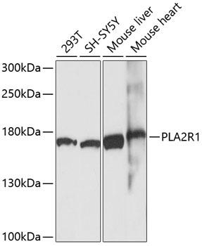 PLA2R / PLA2R1 Antibody - Western blot analysis of extracts of various cell lines using PLA2R1 Polyclonal Antibody at dilution of 1:1000.