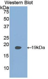 PLAA Antibody - Western blot of recombinant PLAA / PLAP.  This image was taken for the unconjugated form of this product. Other forms have not been tested.