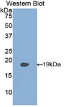 PLAA Antibody - Western blot of recombinant PLAA / PLAP.  This image was taken for the unconjugated form of this product. Other forms have not been tested.