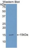 PLAA Antibody - Western blot of recombinant PLAA / PLAP.  This image was taken for the unconjugated form of this product. Other forms have not been tested.