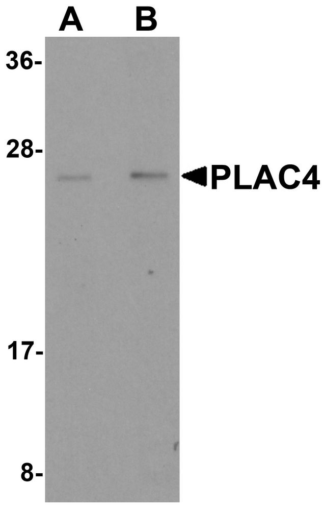 PLAC4 Antibody - Western blot analysis of PLAC4 in human placenta tissue lysate with PLAC4 antibody at (A) 1 and (B) 2 ug/ml.