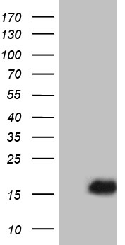 PLAC8 Antibody - HEK293T cells were transfected with the pCMV6-ENTRY control. (Left lane) or pCMV6-ENTRY PLAC8. (Right lane) cDNA for 48 hrs and lysed