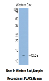 PLAC9 Antibody - Western blot of recombinant PLAC9.  This image was taken for the unconjugated form of this product. Other forms have not been tested.