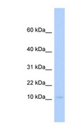 PLAC9 Antibody - PLAC9 antibody Western blot of Fetal Heart lysate. This image was taken for the unconjugated form of this product. Other forms have not been tested.