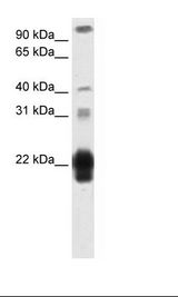 Placental Lactogen Antibody - Placenta Lysate.  This image was taken for the unconjugated form of this product. Other forms have not been tested.